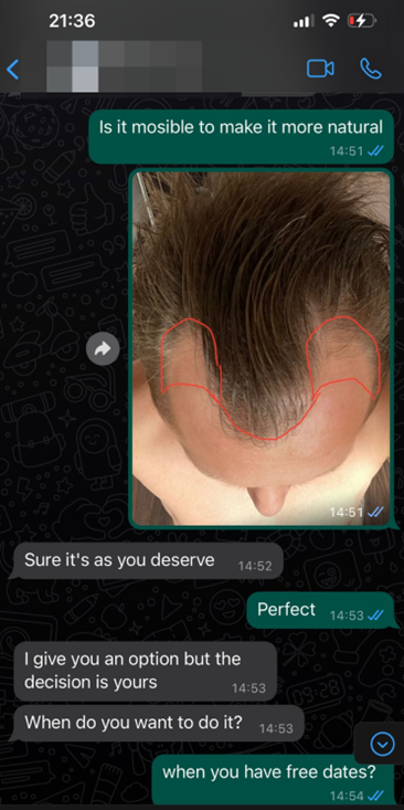 whatsapp κλινική μεταμόσχευσης μαλλιών 4
