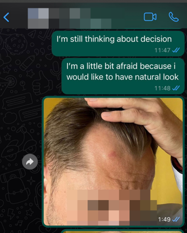 whatsapp κλινική μεταμόσχευσης μαλλιών 3
