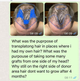 μήνυμα whatsapp κλινική μεταμόσχευσης μαλλιών 6
